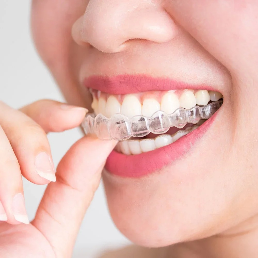 Dental Guard Night - 1-4 szt. Ochraniacz na usta przeciw