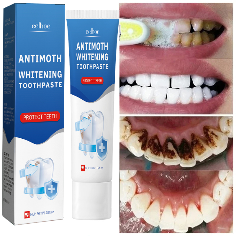 Teeth Whitening Fast - Szybkie usuwanie plam z dymu Pasta
