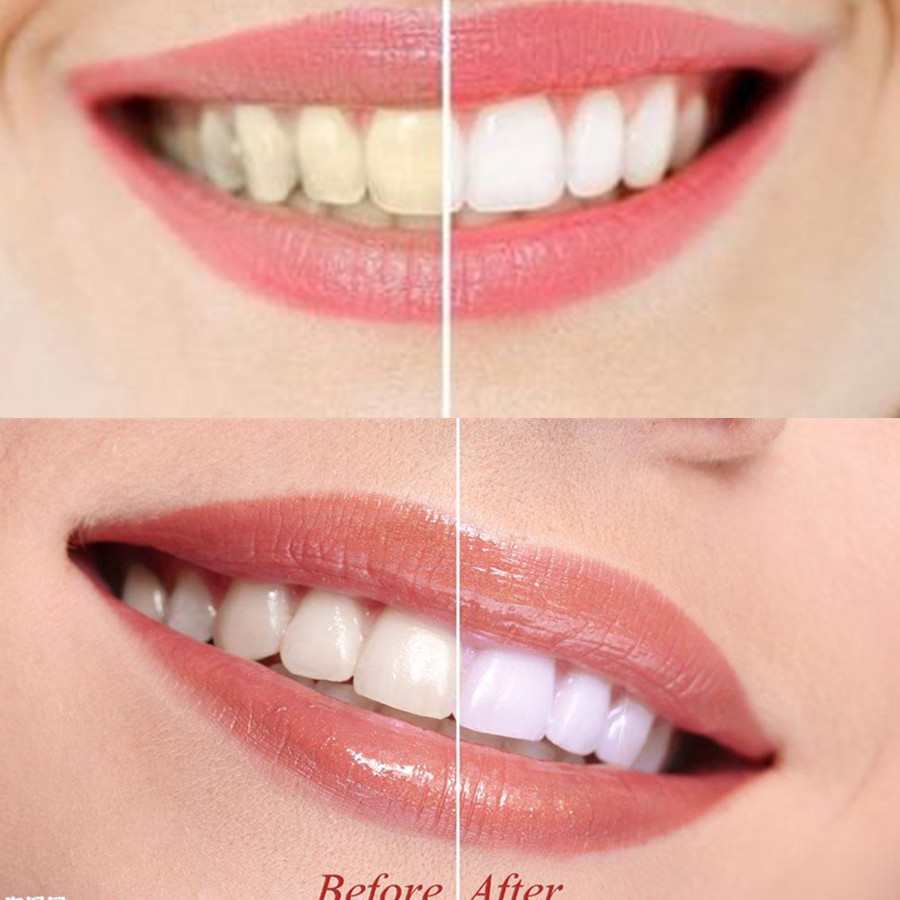 Bambusowy węgiel drzewny zęby  – Teeth Whitening Charcoal recenzja i cena