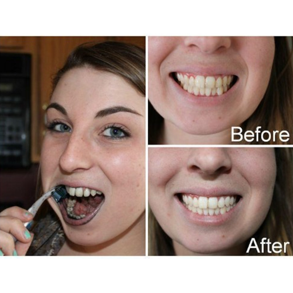Bambusowy węgiel drzewny zęby  – Teeth Whitening Charcoal recenzja i cena