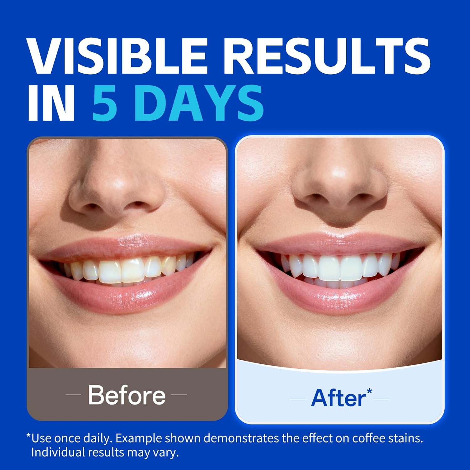 7 par pasków do wybielania zęb – Teeth Whitening Strips Permanent recenzja i cena