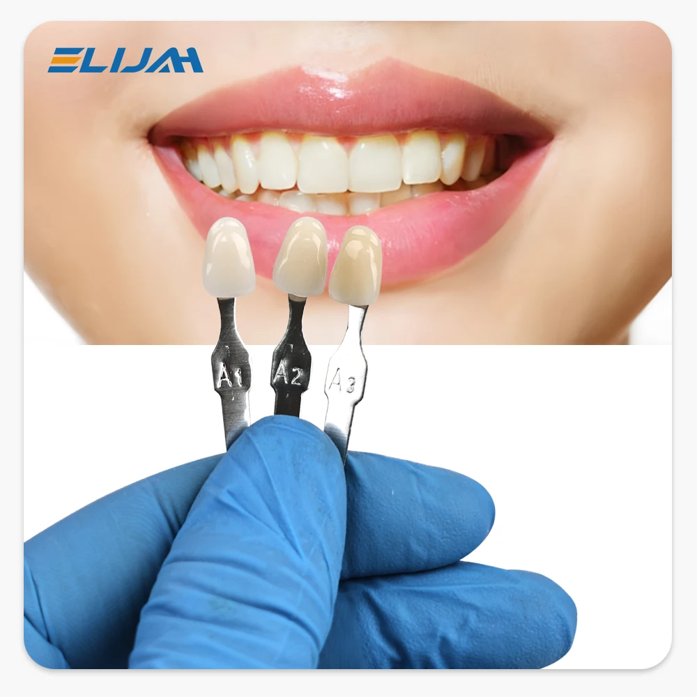 Kolorowy przewodnik do wybiela – Teeth Whitening/Bleaching recenzja i cena