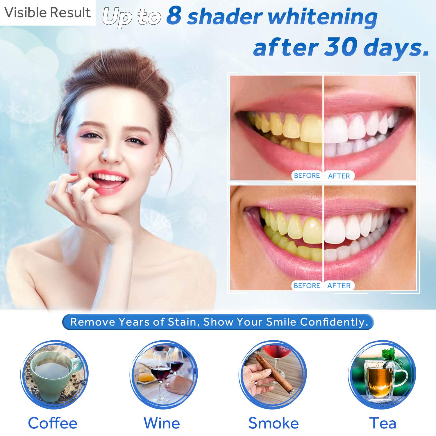 Żel do wybielania zębów w strz – Teeth Whitening Procedure recenzja i cena