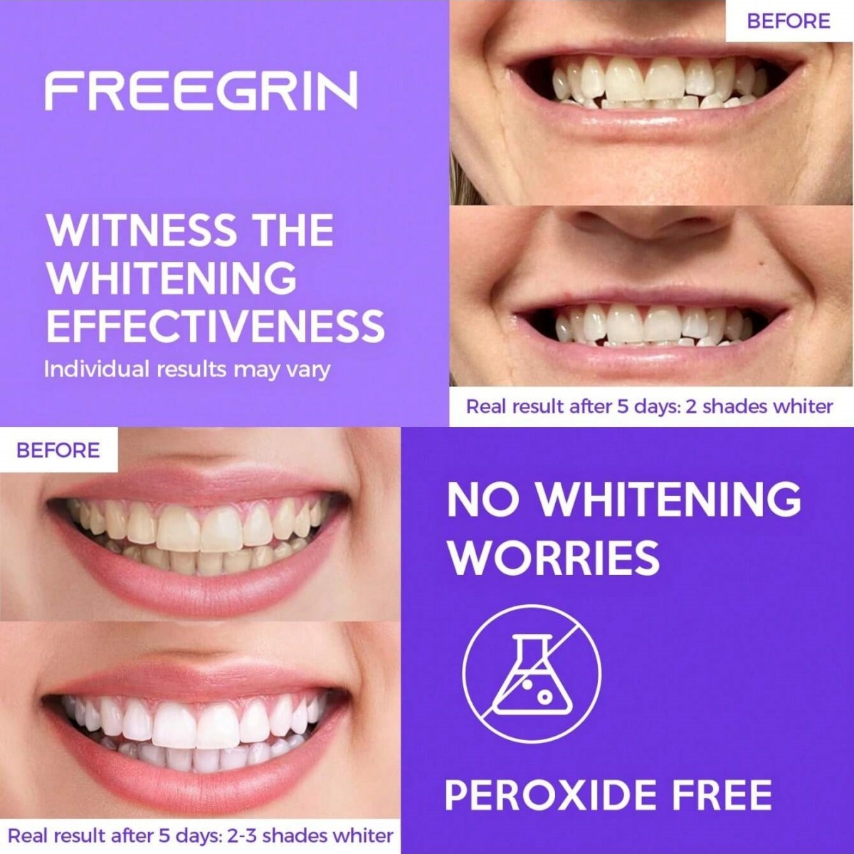 Naklejki wybielające do zębów  – Teeth Whitening Hydrogen Peroxide recenzja i cena