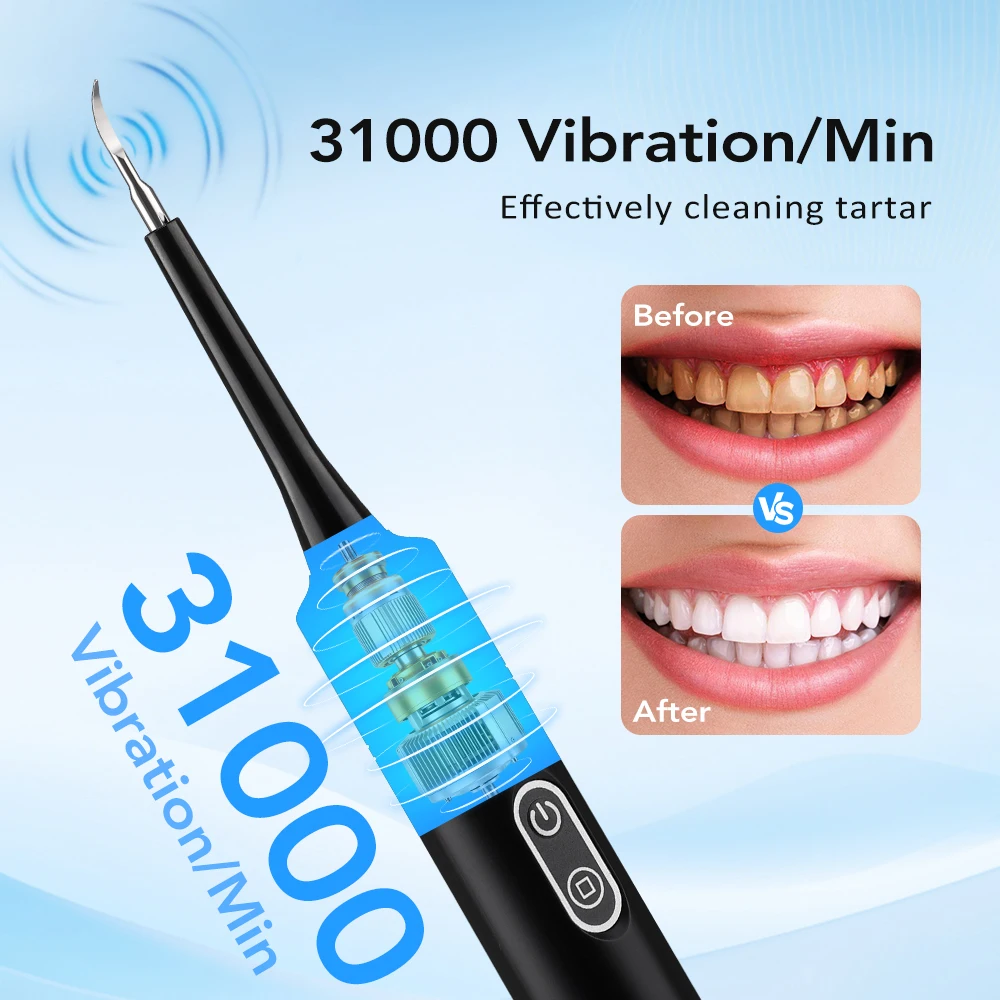 Elektryczny soniczny skaler de – Teeth Whitening Toothbrush recenzja i cena