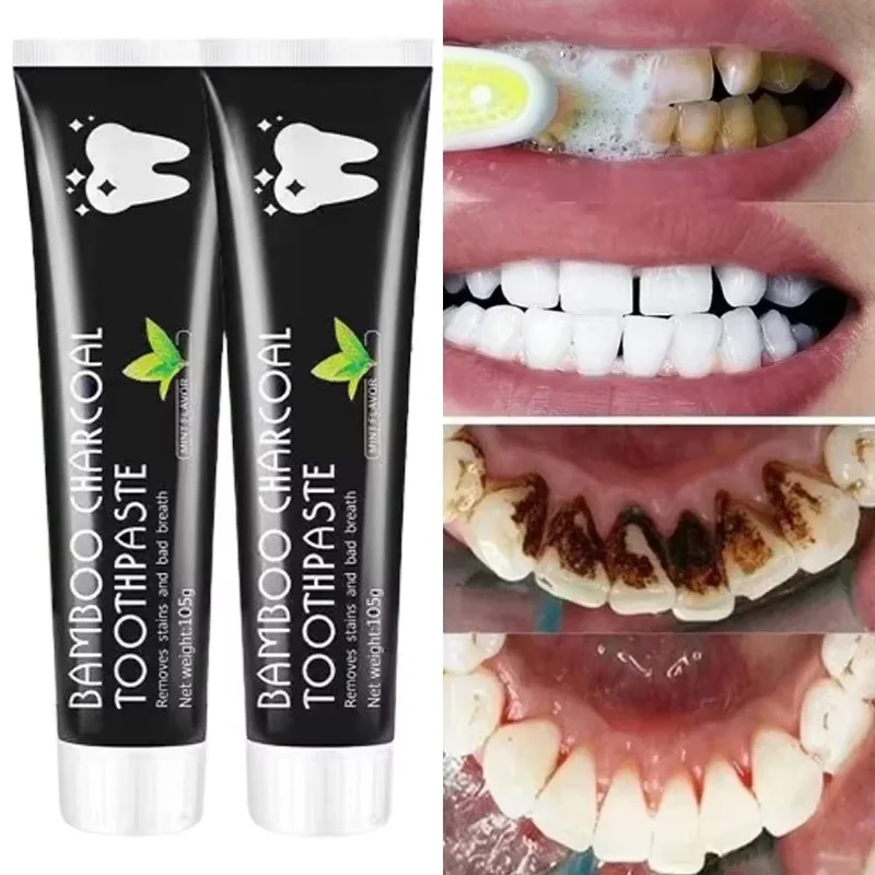 Wybielająca pasta do zębów z w – Teeth Whitening Charcoal recenzja i cena